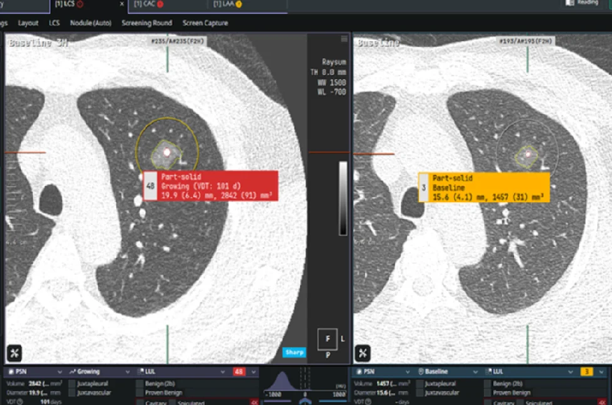 telemedecine technologies news